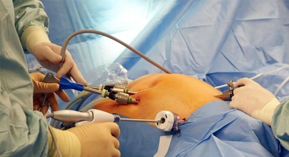 drpsathas-ioannis-psathas-genikos-xeirourgos-athina-karkinos-paxeos-enterou-xeiroyrgeio