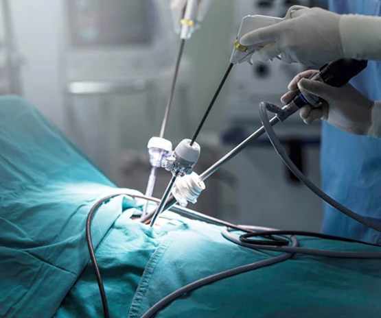 drpsathas-ioannis-psathas-genikos-xeirourgos-athina-xololithiash-xeiroyrgeio